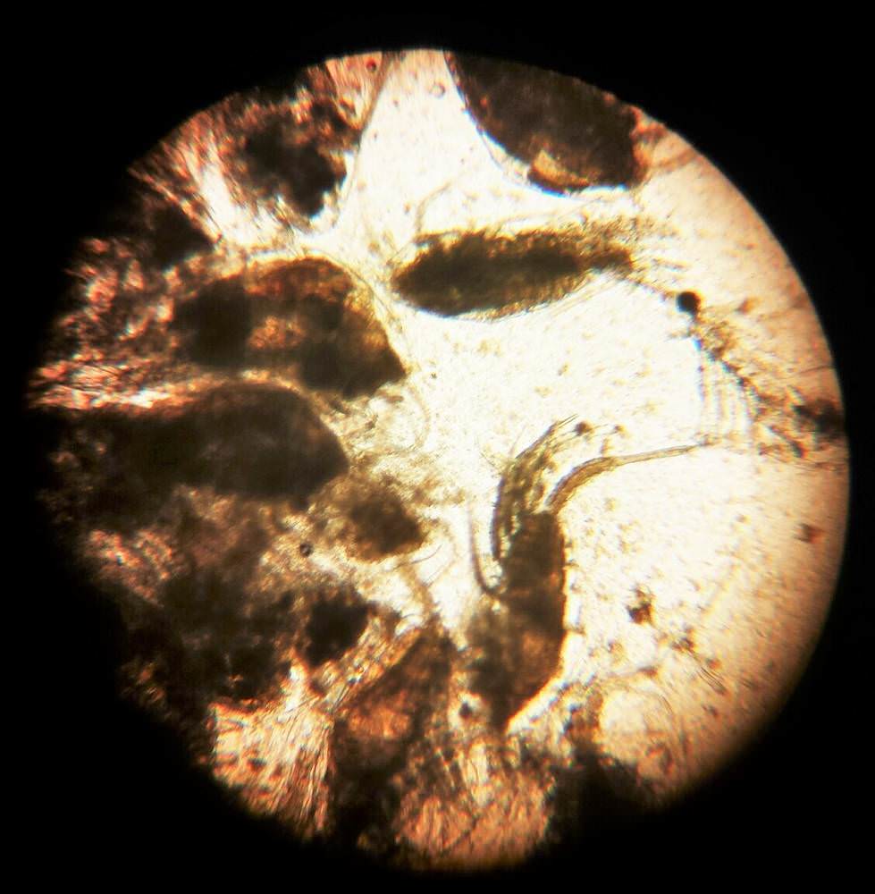 microscopio